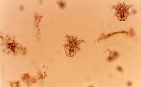 Bacterias