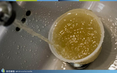 Caraqueños, tienen riesgo de contraer 6 enfermedades por agua contaminada